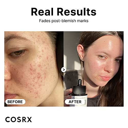 The Niacinamide 15 / 20ml