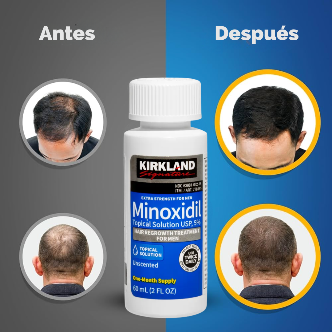 Minoxidil Kirkland 5% (6) / 60ml